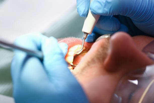 Best Emergency Dental Care for Abscessed Tooth in Fruitland, MD
