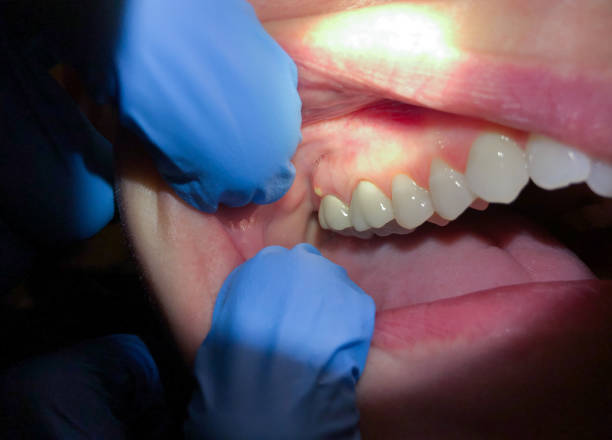 Best Pediatric Emergency Dentist in Fruitland, MD